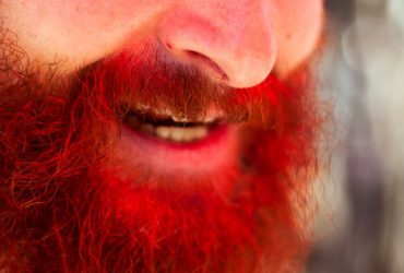 How to Conquer Beard Dandruff Once and for All